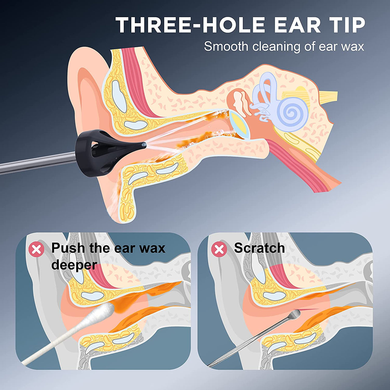 EarWaxGentle™️ - Your Ultimate Ear Care Solution!